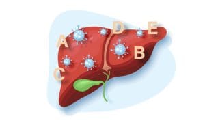 Hepatita virală (A, B, C, D, E)
